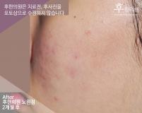 전후사진