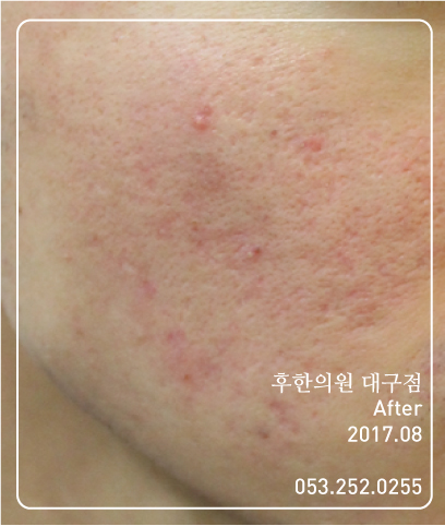 전후사진