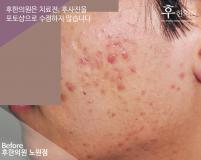 전후사진