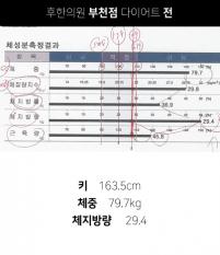 전후사진