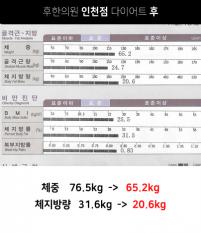 전후사진