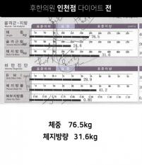 전후사진