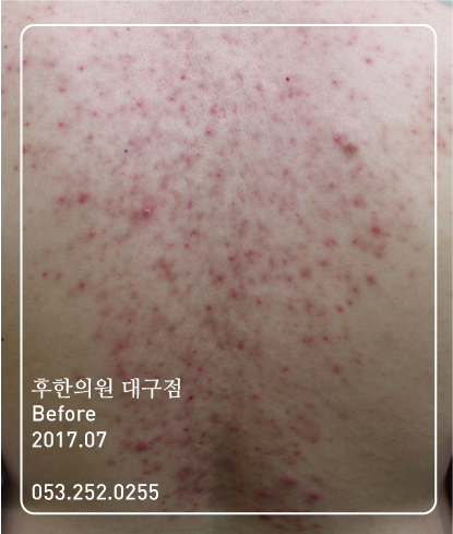 전후사진