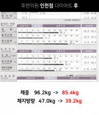 전후사진