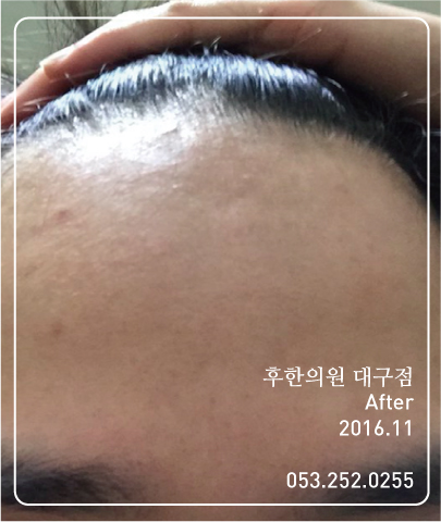 전후사진