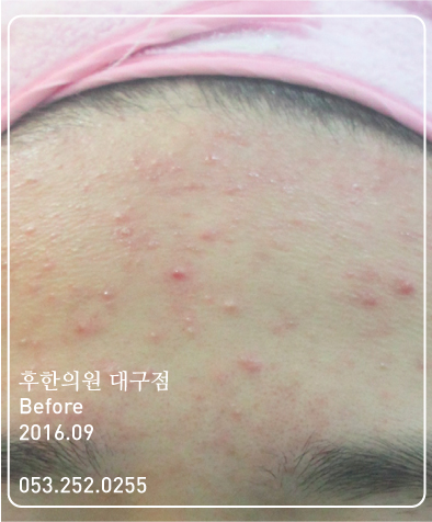 전후사진