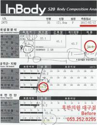 전후사진