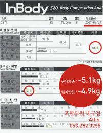 전후사진