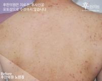 전후사진