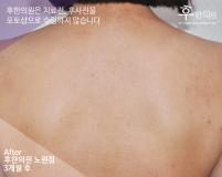 전후사진