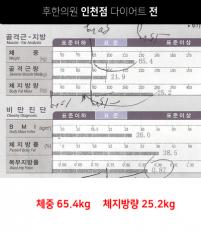 전후사진