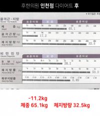 전후사진