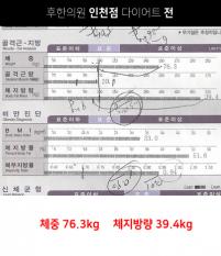 전후사진
