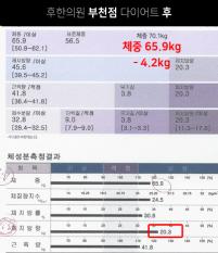 전후사진