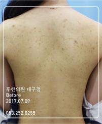 전후사진