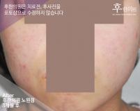 전후사진