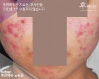 전후사진