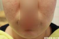 전후사진