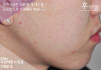 전후사진