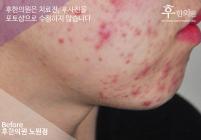 전후사진