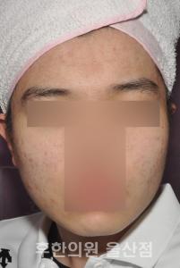 전후사진