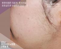 전후사진