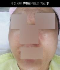전후사진