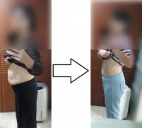 전후사진