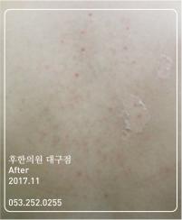 전후사진