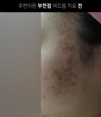 전후사진