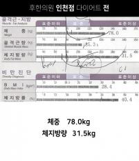 전후사진