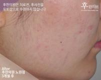 전후사진