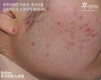 전후사진