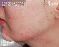 전후사진