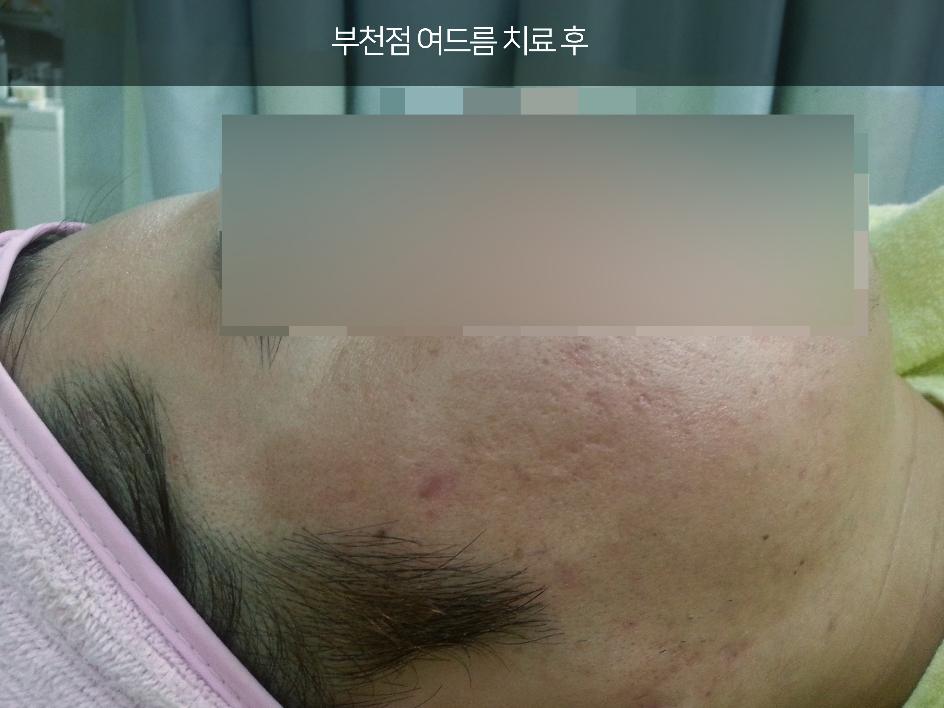 전후사진