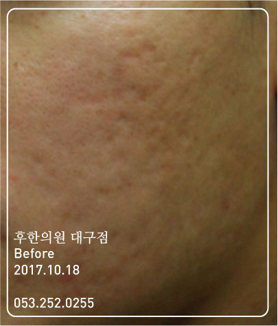 전후사진