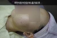 전후사진