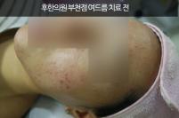 전후사진