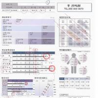 전후사진