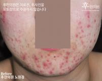 전후사진
