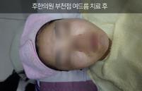 치료 후