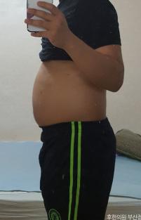 전후사진