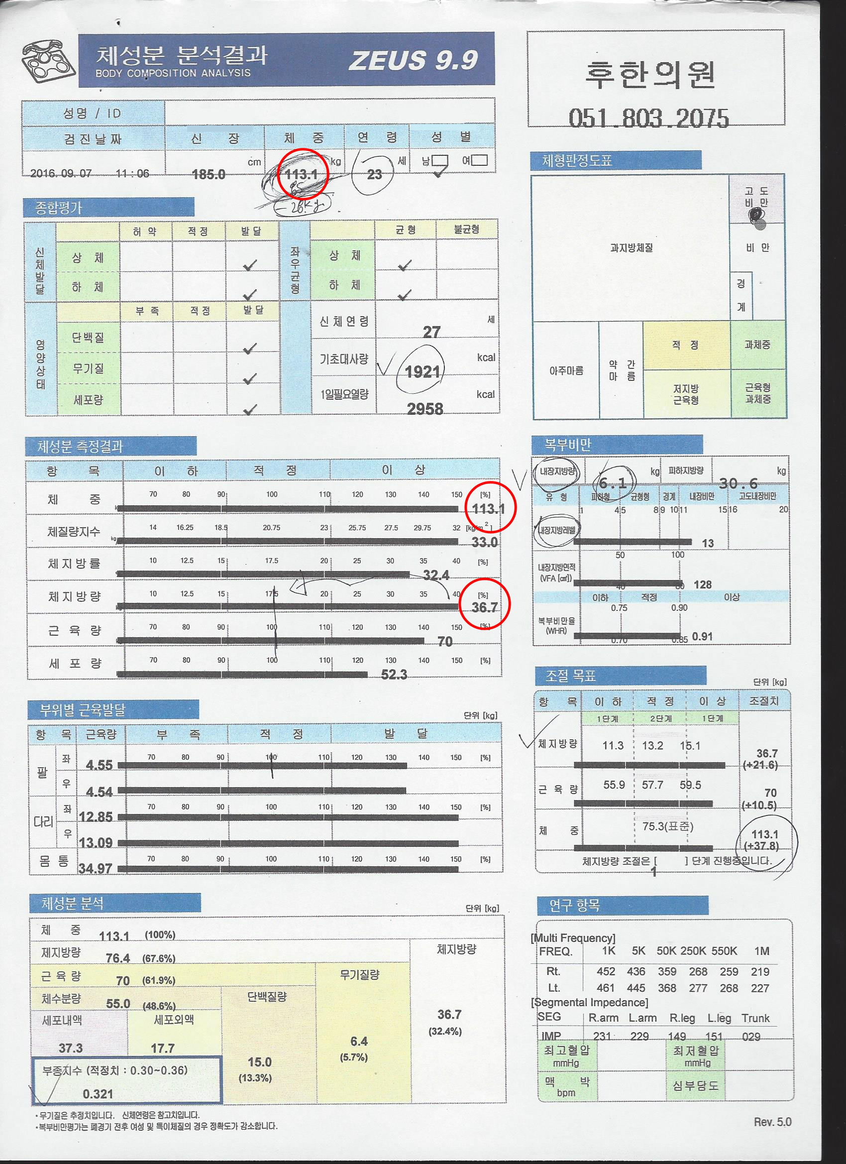 전후사진