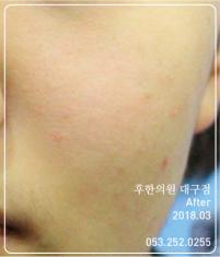 전후사진