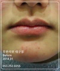 전후사진