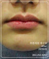 전후사진
