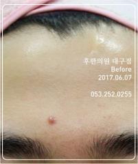 전후사진