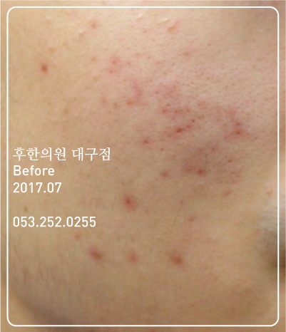 전후사진