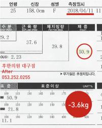 전후사진