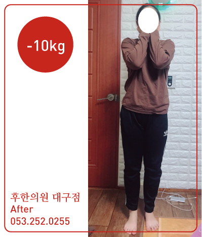 전후사진